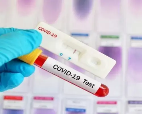 Эпидемическая ситуация по COVID-19 в Харьковской области