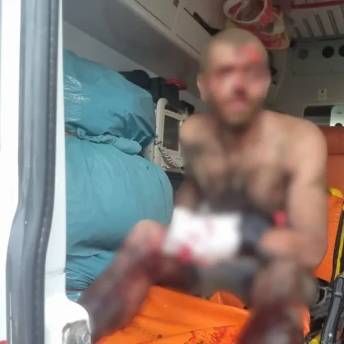 На Харківщині чоловік підірвався на вибуховому пристрої: його госпіталізували