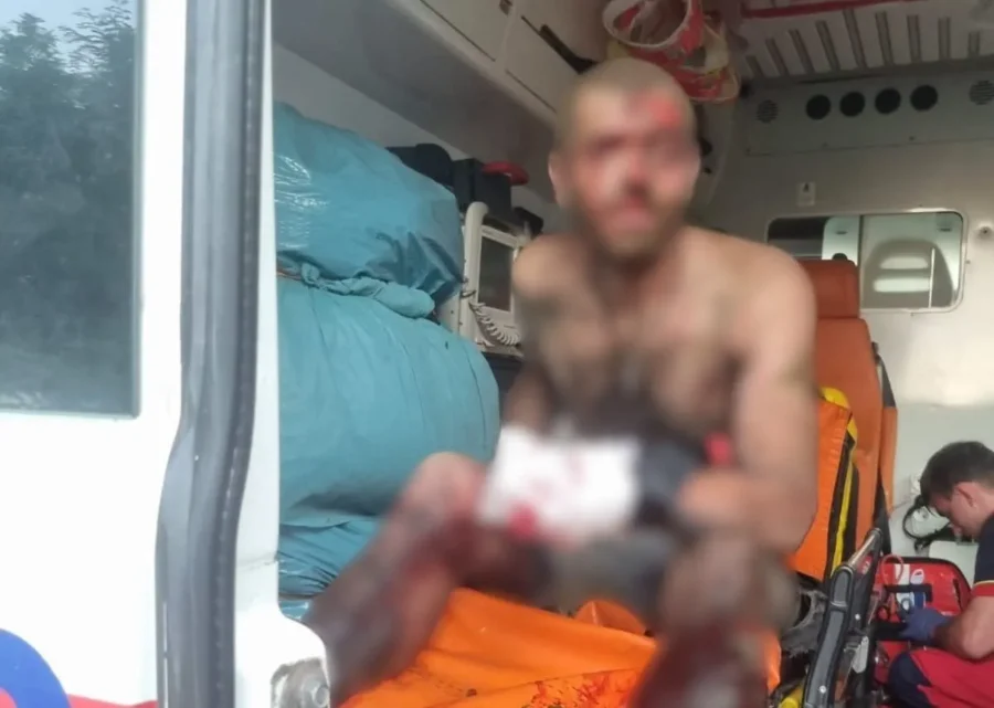 На Харківщині чоловік підірвався на вибуховому пристрої: його госпіталізували